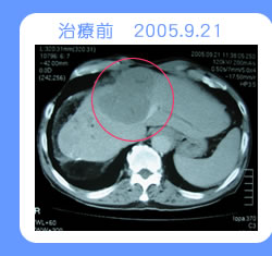 治療前